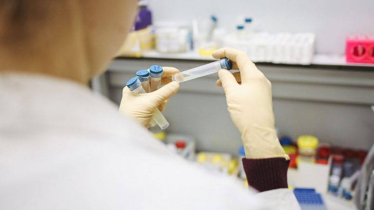 person holding test tubes 3735747