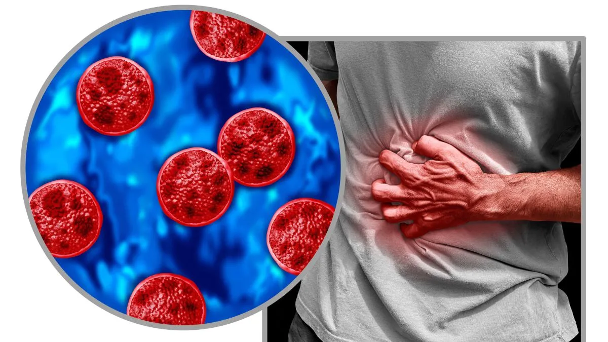 ciclosporiasis.jpg