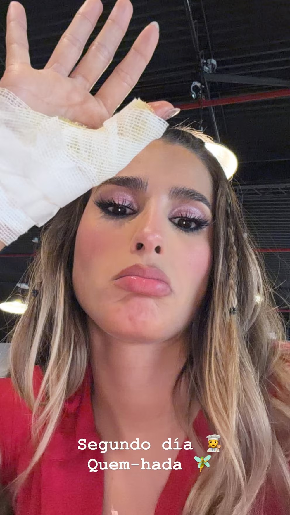 Juli Poggio fue la primera accidentada del reality: mostró su quemadura y contó cómo vive las grabaciones 1